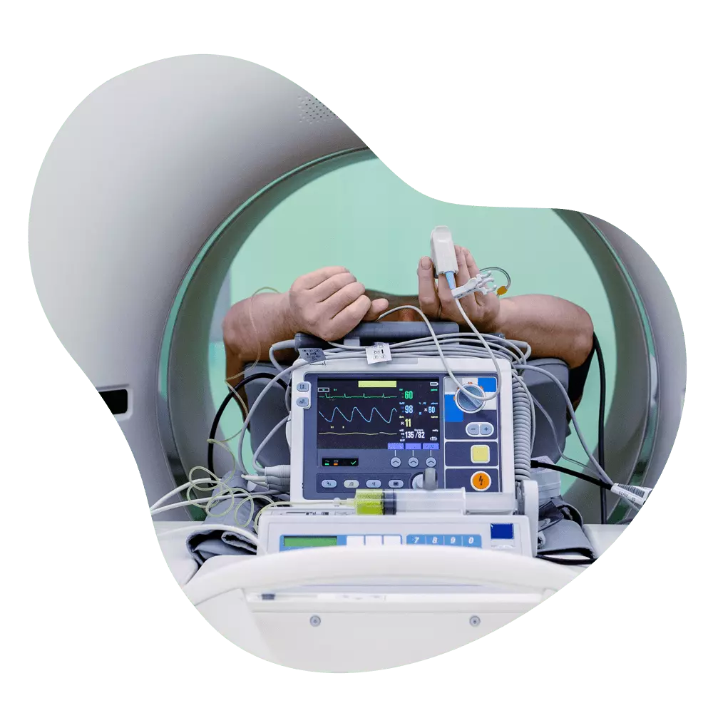 Angio CT Scan