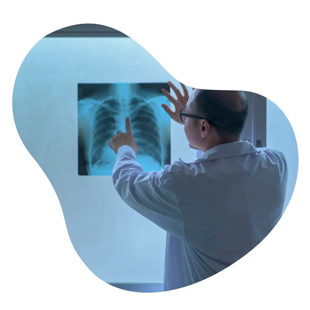 Chest CT Scan