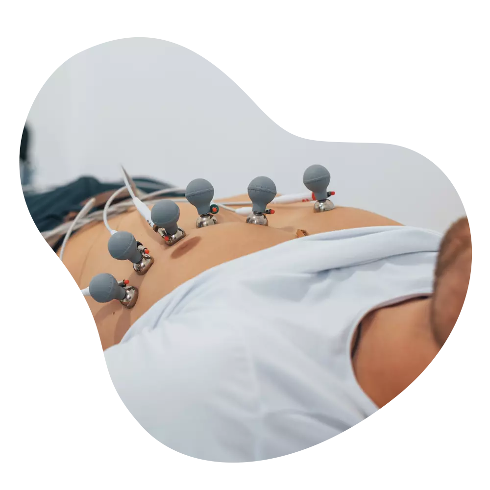 ECG Test