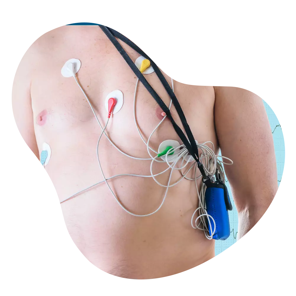 Holter Test