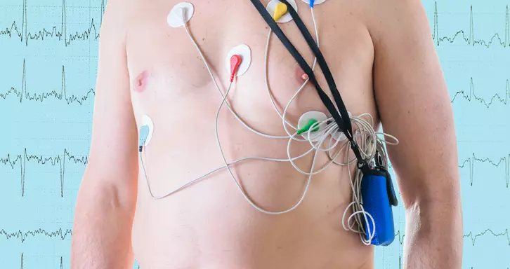 Holter Monitor